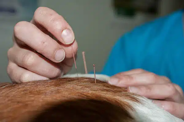Acupuncture 4