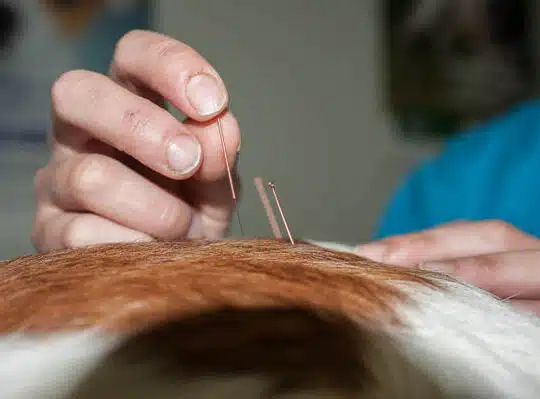 Acupuncture 5